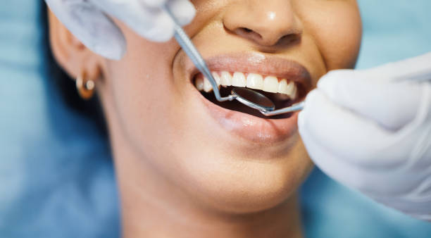 Best Emergency Cosmetic Dentistry (e.g., broken veneers) in Bentleyville, PA